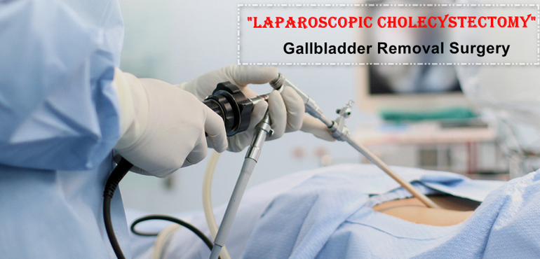 Laparoscopic cholecystectomy Cost in Delhi

